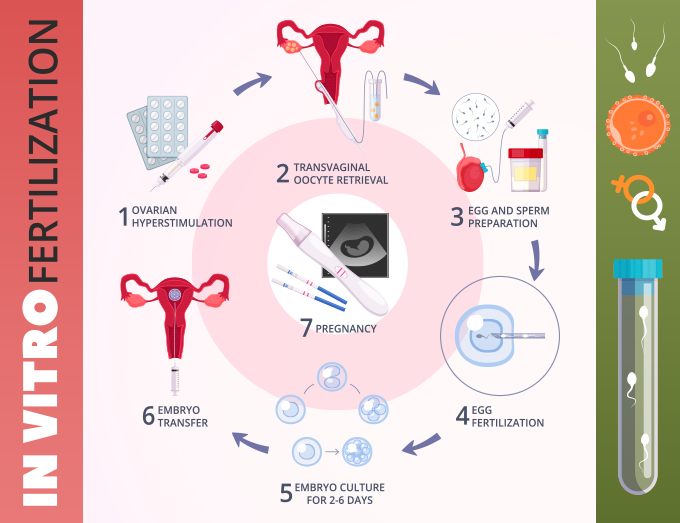 process of IVF