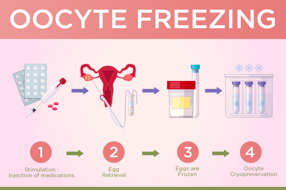 risks associated with oocyte freezing