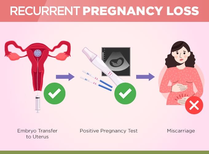 Recurrent Pregnancy Loss