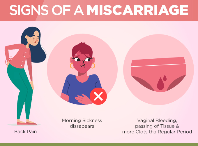 Signs of miscarriage