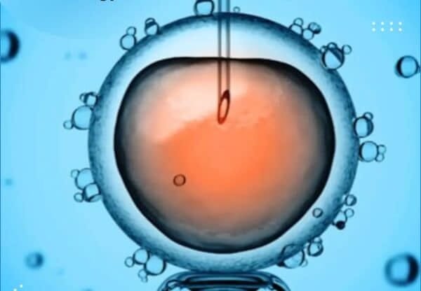 All You Need to Know About Assisted Reproductive Technology