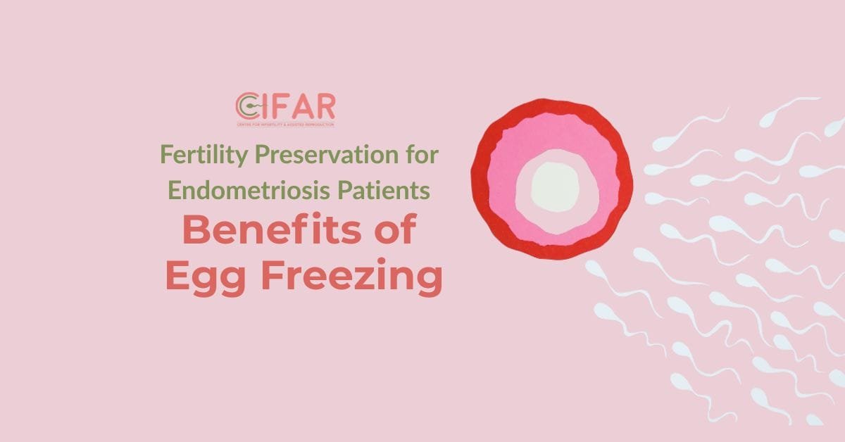 Fertility Preservation for Endometriosis Patients: The Benefits of Egg Freezing