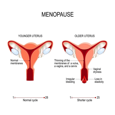 Menopause & Fertility - What Every Woman Should Know Before Planning Pregnancy? 1 menopause treatment